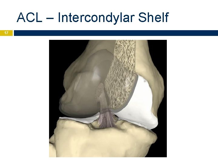 ACL – Intercondylar Shelf 17 