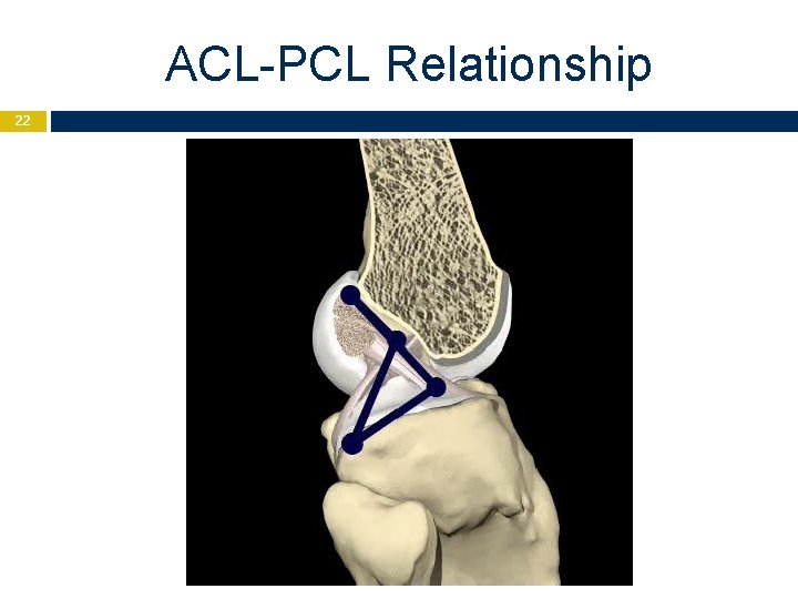 ACL-PCL Relationship 22 