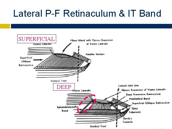 Lateral P-F Retinaculum & IT Band SUPERFICIAL DEEP 