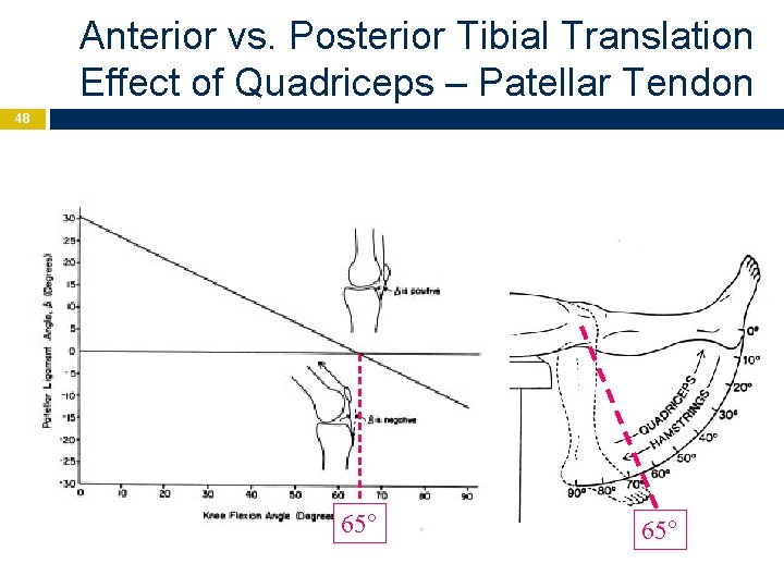 Anterior vs. Posterior Tibial Translation Effect of Quadriceps – Patellar Tendon 48 65° 