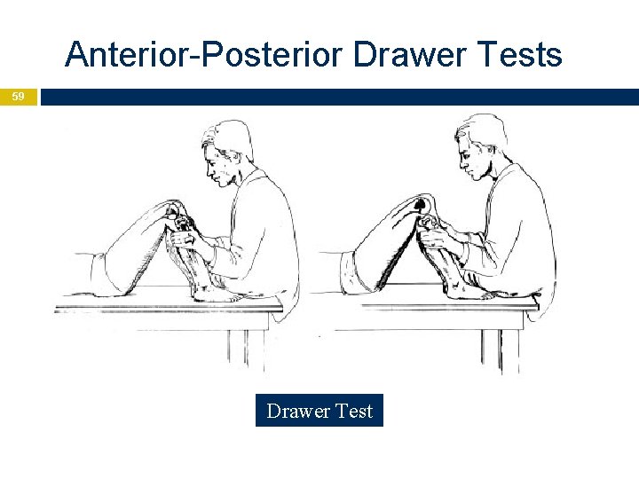 Anterior-Posterior Drawer Tests 59 Drawer Test 