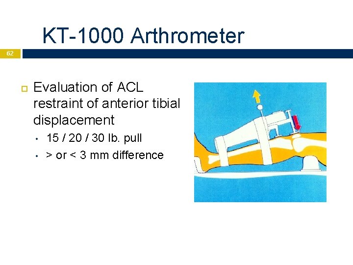 KT-1000 Arthrometer 62 Evaluation of ACL restraint of anterior tibial displacement • • 15