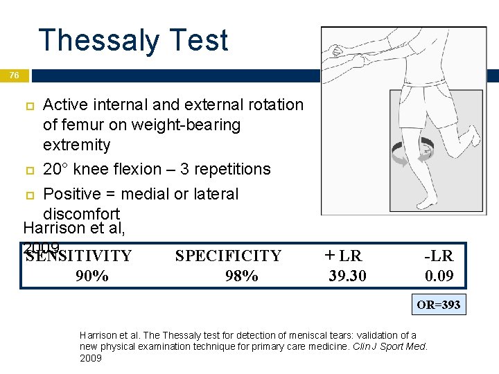 Thessaly Test 76 Active internal and external rotation of femur on weight-bearing extremity 20°