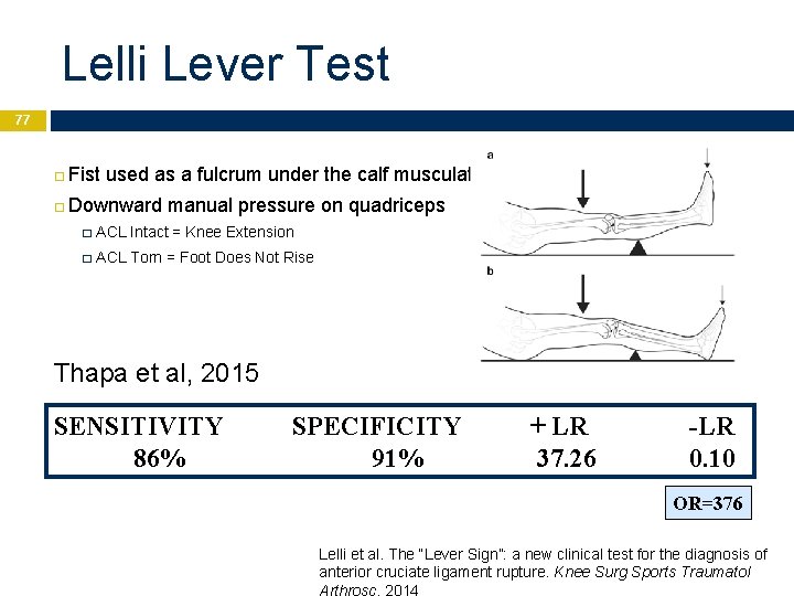 Lelli Lever Test 77 Fist used as a fulcrum under the calf musculature Downward