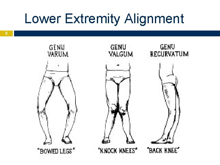 Lower Extremity Alignment 8 