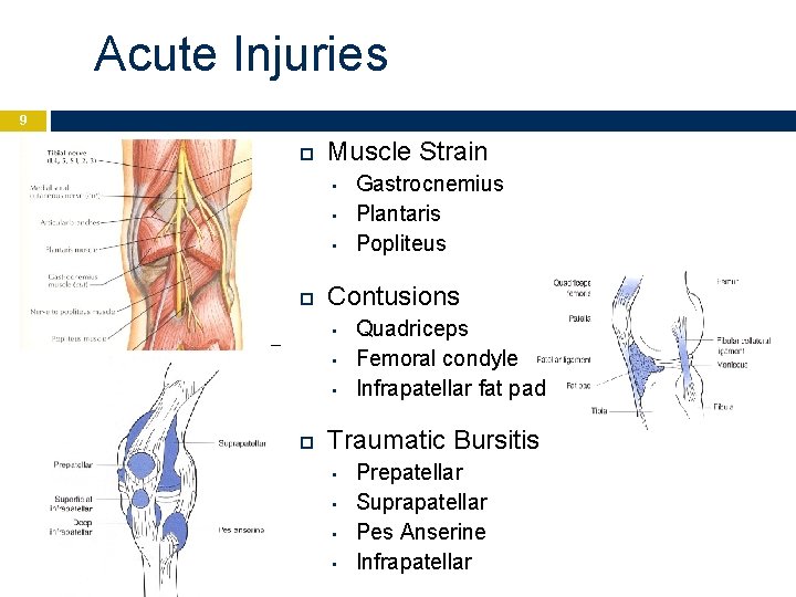 Acute Injuries 9 Muscle Strain • • • Contusions • • • Gastrocnemius Plantaris