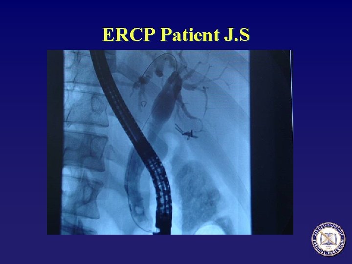 ERCP Patient J. S 