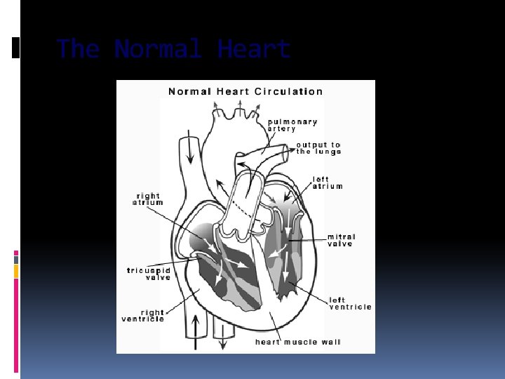 The Normal Heart 