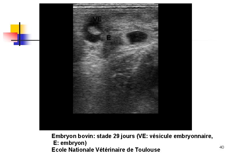 VE E Embryon bovin: stade 29 jours (VE: vésicule embryonnaire, E: embryon) Ecole Nationale