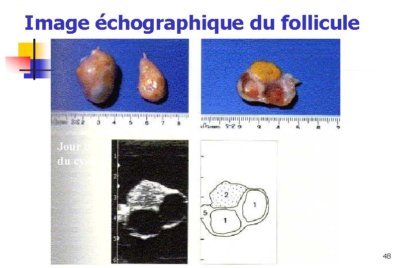 Image échographique du follicule Jour 0 du cycle 48 