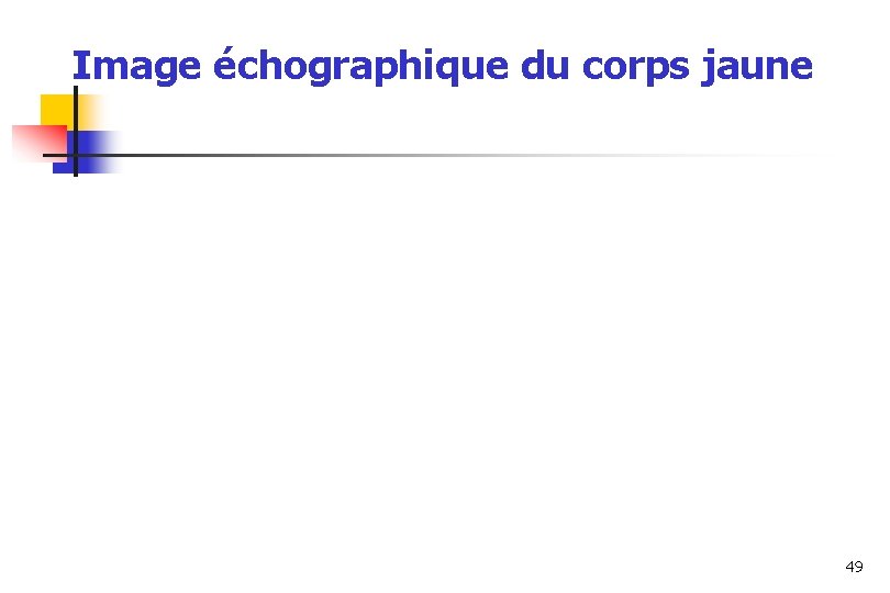 Image échographique du corps jaune 49 Image échographique du corps jaune 49