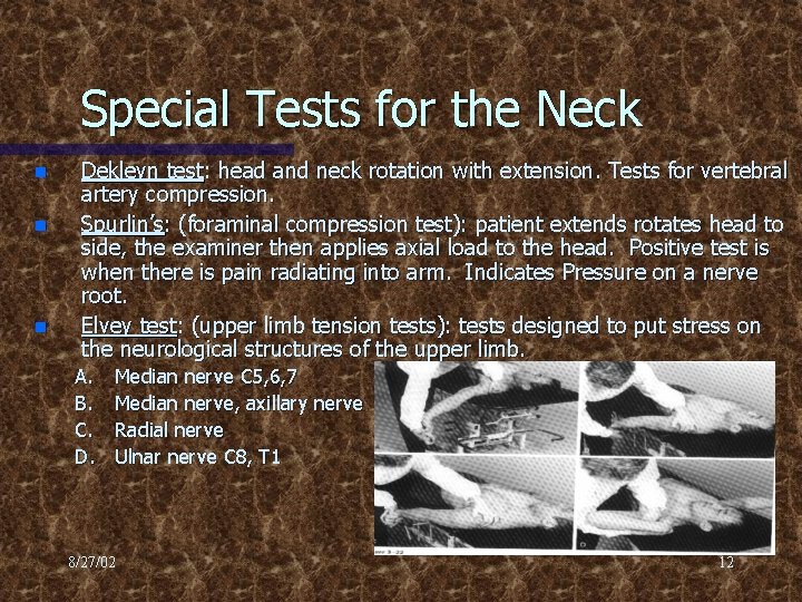 Special Tests for the Neck n n n Dekleyn test: head and neck rotation