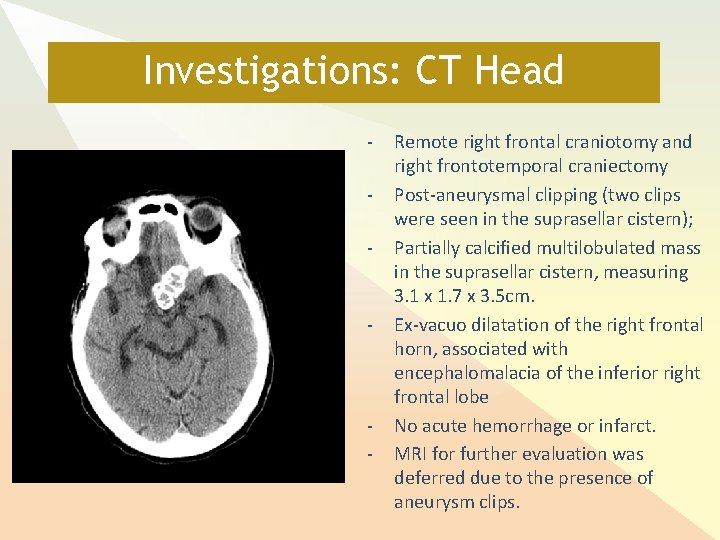 Investigations: CT Head - - - Remote right frontal craniotomy and right frontotemporal craniectomy