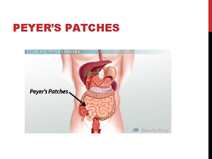 PEYER’S PATCHES 