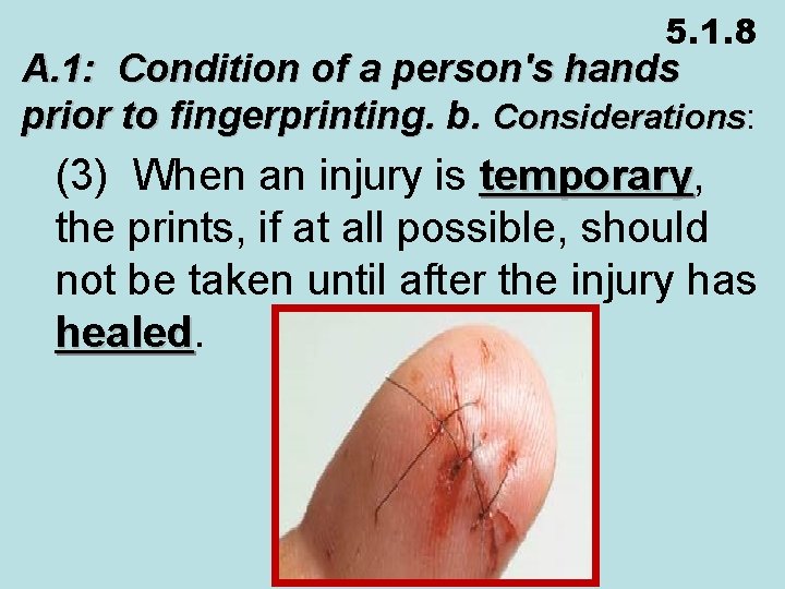 5. 1. 8 A. 1: Condition of a person's hands prior to fingerprinting. b.