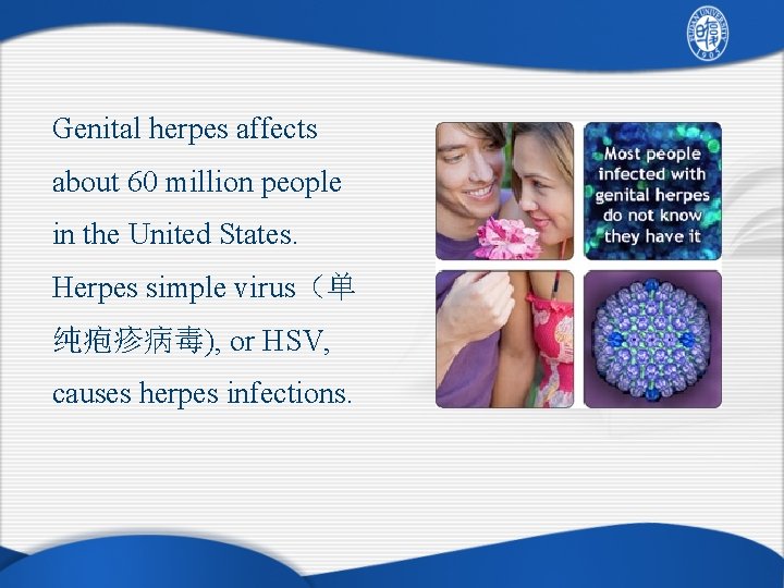 Genital herpes affects about 60 million people in the United States. Herpes simple virus（单