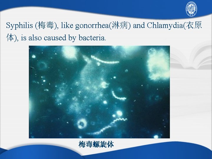 Syphilis (梅毒), like gonorrhea(淋病) and Chlamydia(衣原 体), is also caused by bacteria. 梅毒螺旋体 