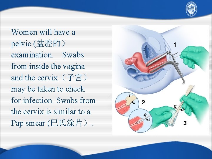 Women will have a pelvic (盆腔的） examination. 　Swabs from inside the vagina and the