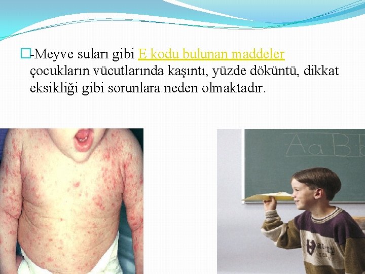 �-Meyve suları gibi E kodu bulunan maddeler çocukların vücutlarında kaşıntı, yüzde döküntü, dikkat eksikliği