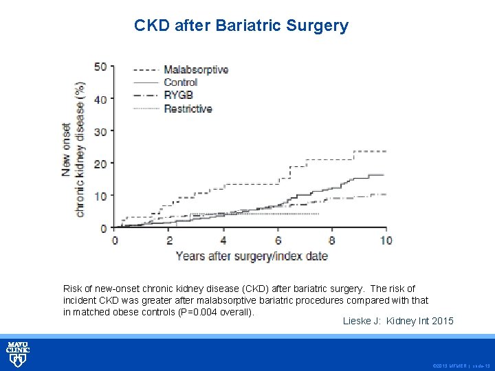 CKD after Bariatric Surgery Risk of new-onset chronic kidney disease (CKD) after bariatric surgery.