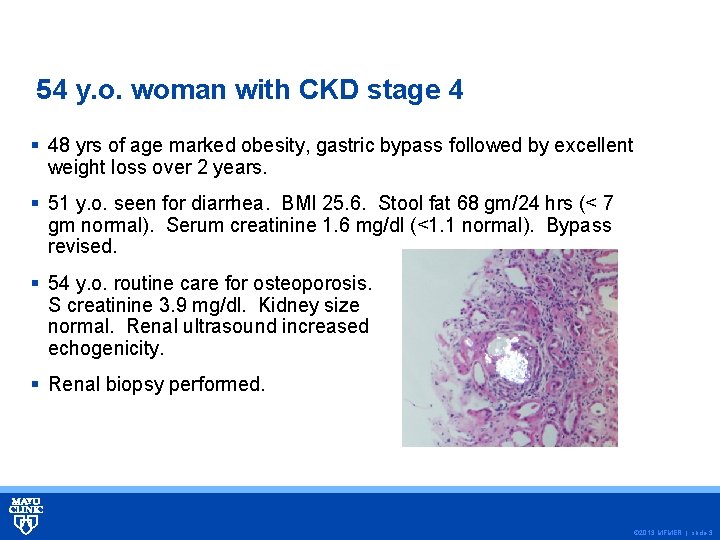54 y. o. woman with CKD stage 4 § 48 yrs of age marked