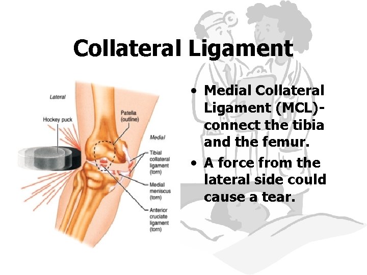 Collateral Ligament • Medial Collateral Ligament (MCL)connect the tibia and the femur. • A