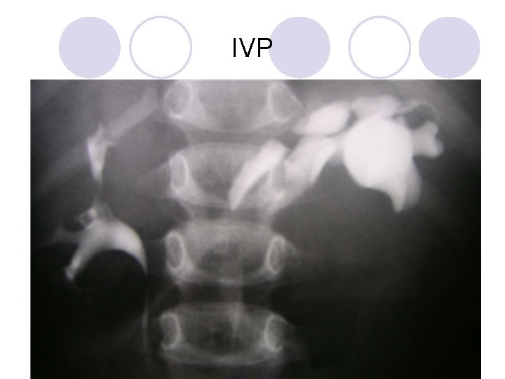 IVP IVP