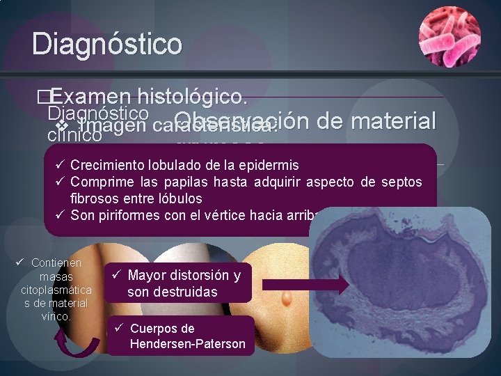 Diagnóstico �Examen histológico. Diagnóstico Observación de material v Imagen característica: clínico grumoso ü Crecimiento