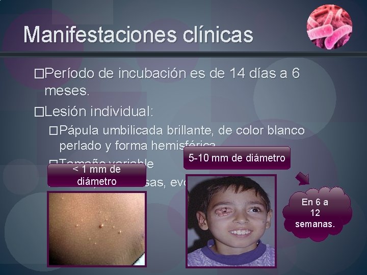 Manifestaciones clínicas �Período de incubación es de 14 días a 6 meses. �Lesión individual:
