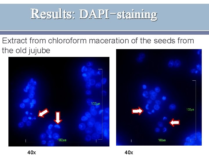 Results: DAPI-staining Extract from chloroform maceration of the seeds from the old jujube 40