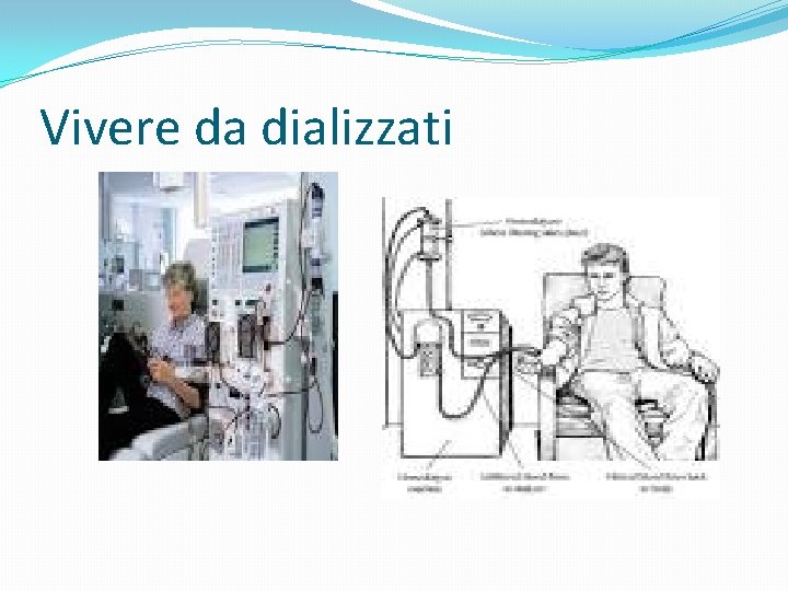 Vivere da dializzati Vivere da dializzati