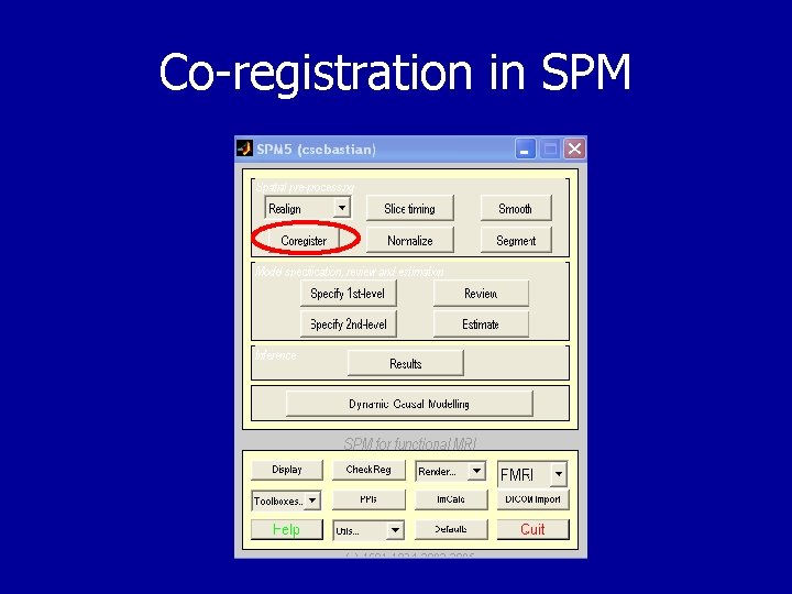 Co-registration in SPM 