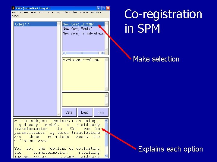 Co-registration in SPM Make selection Explains each option 