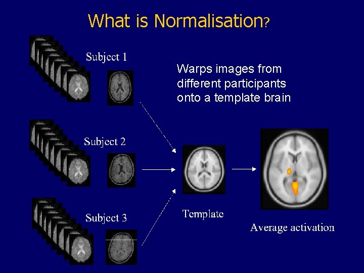 What is Normalisation? Warps images from different participants onto a template brain Matthew Brett