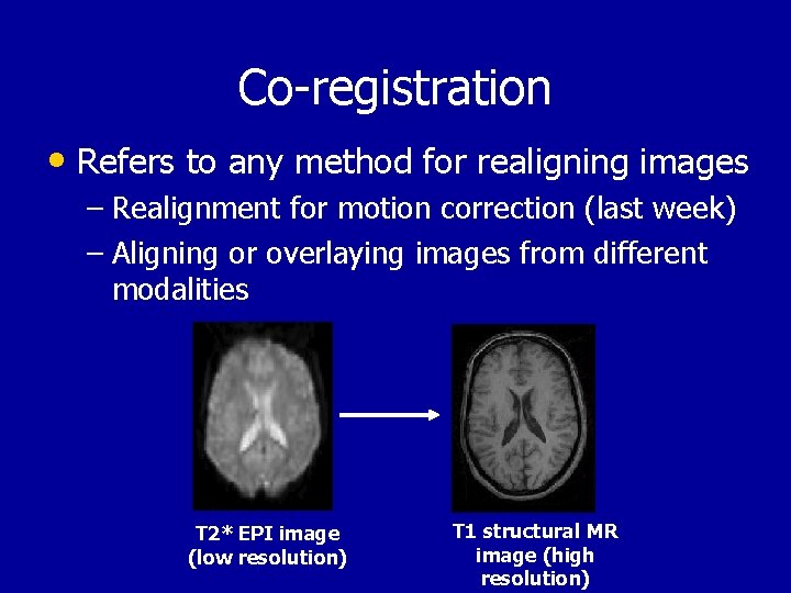 Co-registration • Refers to any method for realigning images – Realignment for motion correction