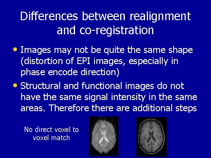 Differences between realignment and co-registration • Images may not be quite the same shape