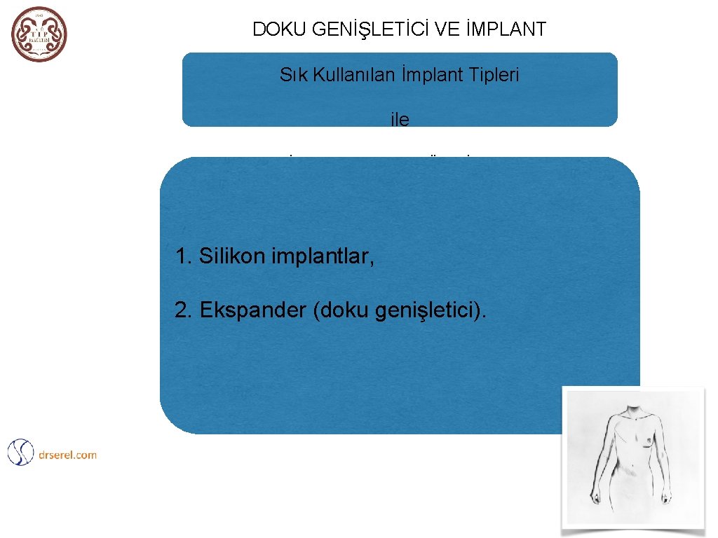 DOKU GENİŞLETİCİ VE İMPLANT Sık Kullanılan İmplant Tipleri ile İLE REKONSTRÜKSİYON 1. Silikon implantlar,