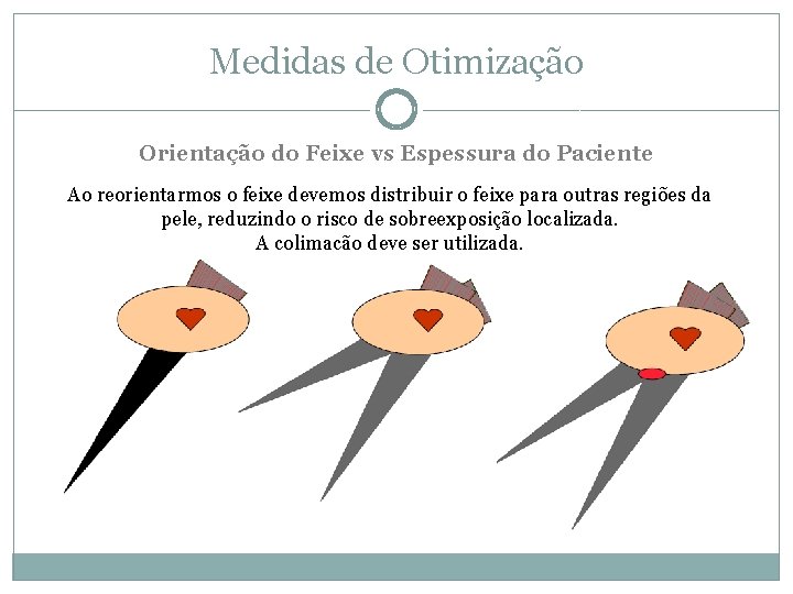 Medidas de Otimização Orientação do Feixe vs Espessura do Paciente Ao reorientarmos o feixe