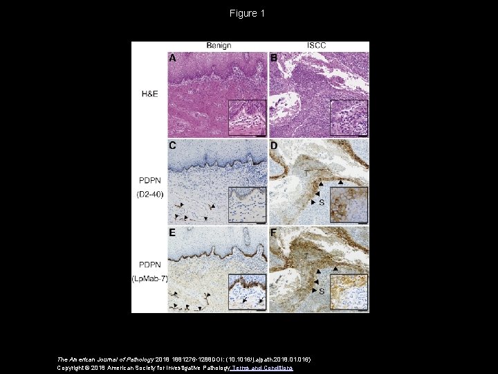 Figure 1 The American Journal of Pathology 2018 1881276 -1288 DOI: (10. 1016/j. ajpath.