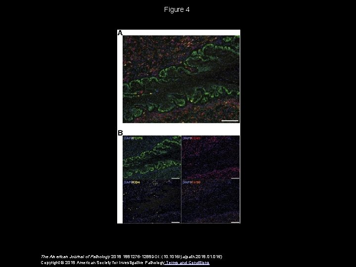 Figure 4 The American Journal of Pathology 2018 1881276 -1288 DOI: (10. 1016/j. ajpath.