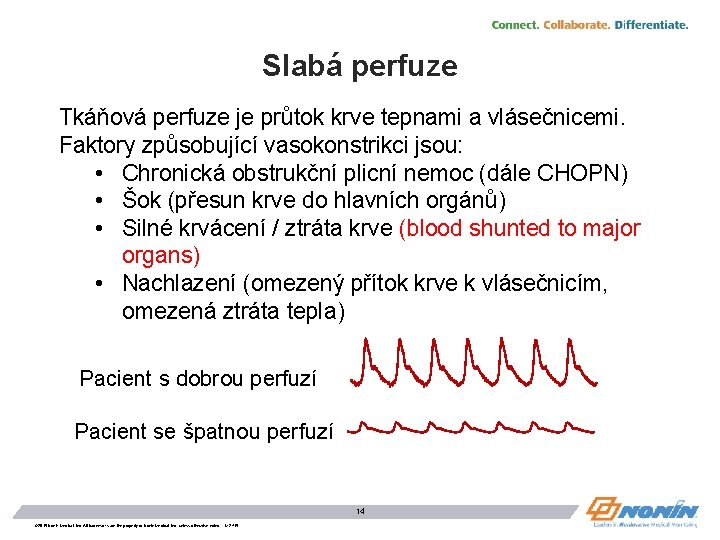 Slabá perfuze Tkáňová perfuze je průtok krve tepnami a vlásečnicemi. Faktory způsobující vasokonstrikci jsou: