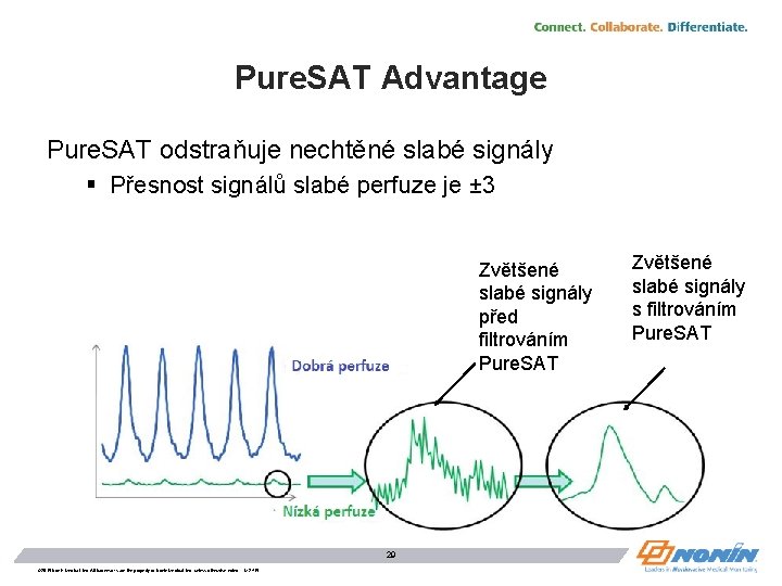 Pure. SAT Advantage Pure. SAT odstraňuje nechtěné slabé signály § Přesnost signálů slabé perfuze