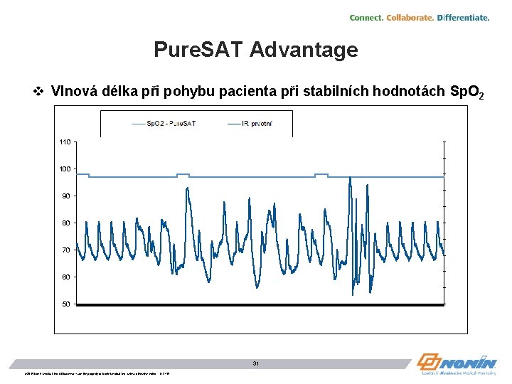 Pure. SAT Advantage v Vlnová délka při pohybu pacienta při stabilních hodnotách Sp. O