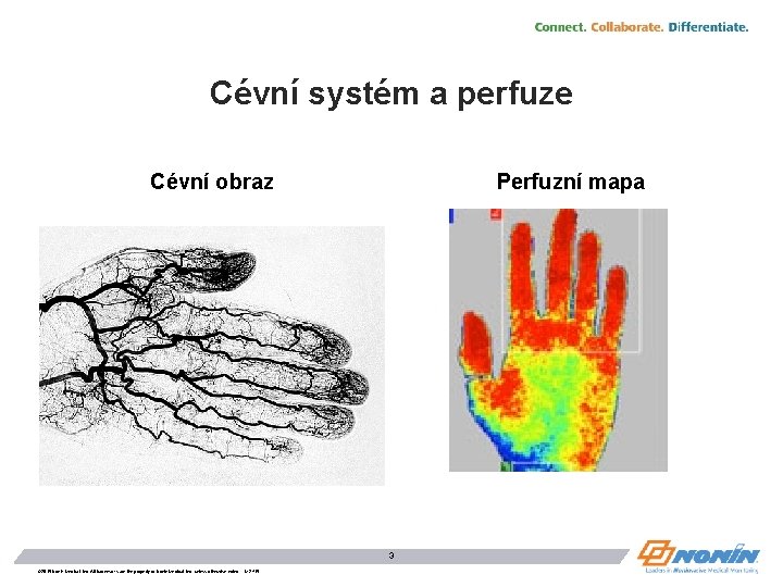 Cévní systém a perfuze Cévní obraz Perfuzní mapa 3 © 2015 Nonin Medical, Inc.