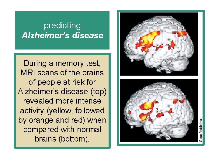 predicting Alzheimer’s disease During a memory test, MRI scans of the brains of people