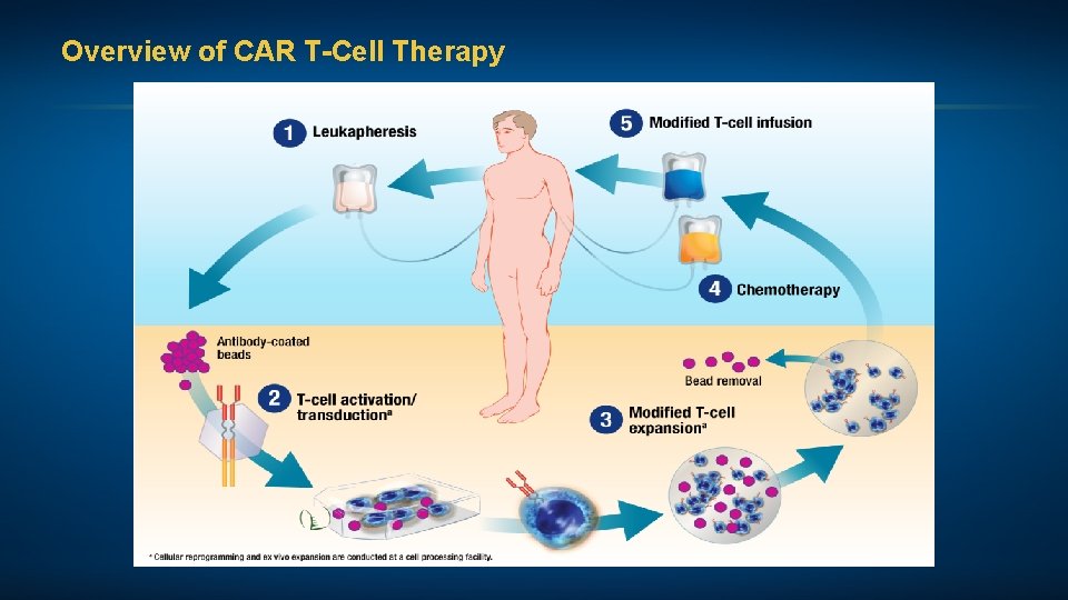 Overview of CAR T-Cell Therapy 