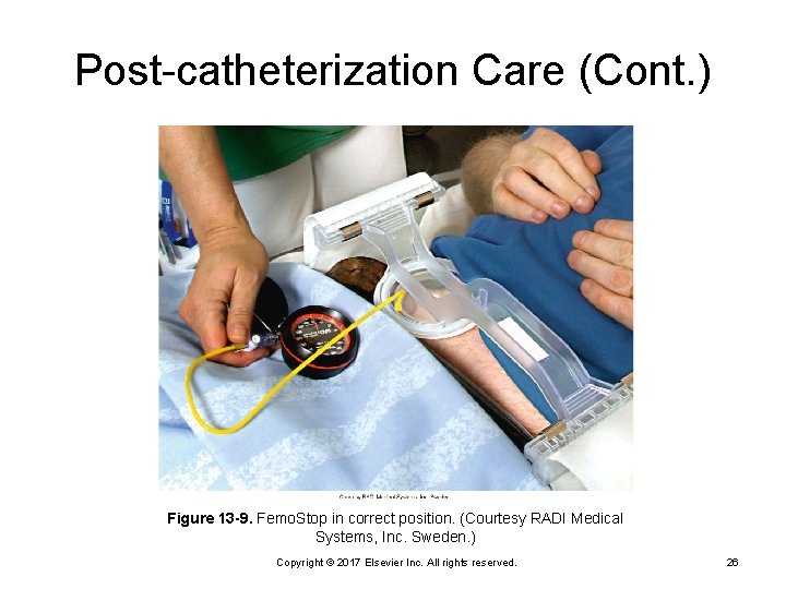 Post-catheterization Care (Cont. ) Figure 13 -9. Femo. Stop in correct position. (Courtesy RADI