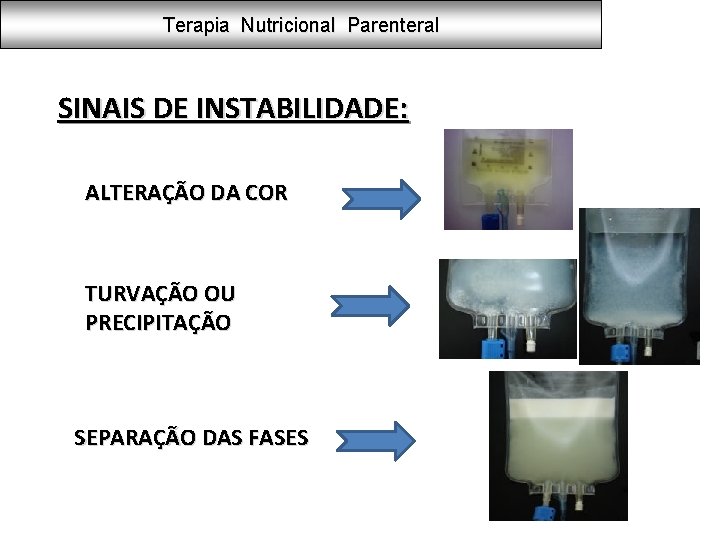 Terapia Nutricional Parenteral SINAIS DE INSTABILIDADE: ALTERAÇÃO DA COR TURVAÇÃO OU PRECIPITAÇÃO SEPARAÇÃO DAS