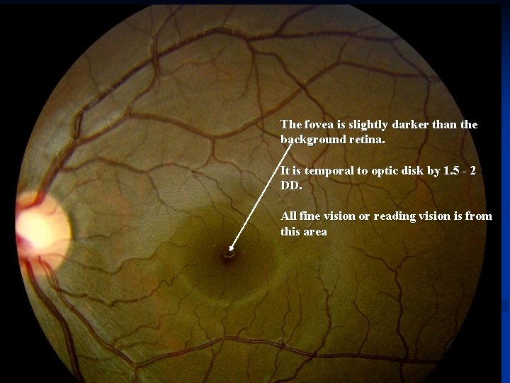 The fovea is slightly darker than the background retina. It is temporal to optic