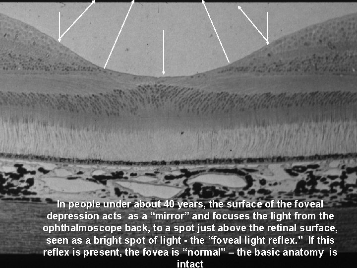 In people under about 40 years, the surface of the foveal depression acts as